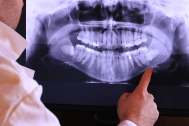 Best Emergency Dental Extractions in Haddon Heights, NJ