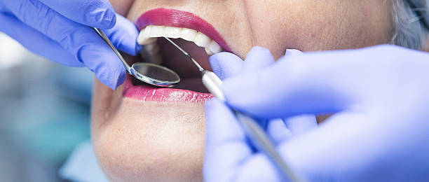 Best Emergency Dentist for Lost Fillings or Crowns in Haddon Heights, NJ